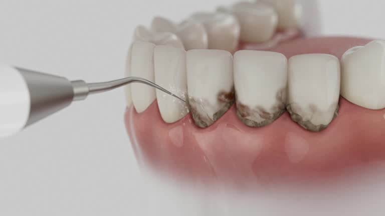 Trusted Emergency Dentist service in Rogers, MN - Dentist Open Now